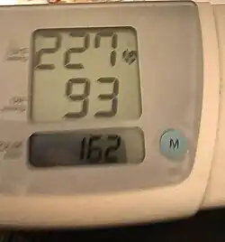 A photo of a home-owned automated arm blood pressure monitor showing an extremely elevated systolic blood pressure of 227 over a mildly elevated diastolic blood pressure of 93 with a tachycardic elevated heart rate of 162 beats per minute, representing an isolated systolic hypertensive crisis.
