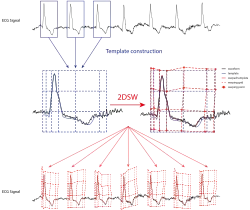 QT interval measurement