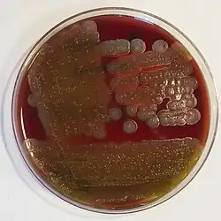 Bacillus cereus: "ground-glass" colonies displaying beta-hemolysis on blood agar: 188