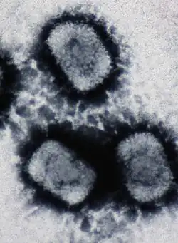 Electron micrograph of three Cowpox virus particles