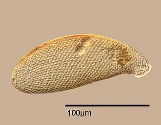 Testate amoeba, Cyphoderia sp.