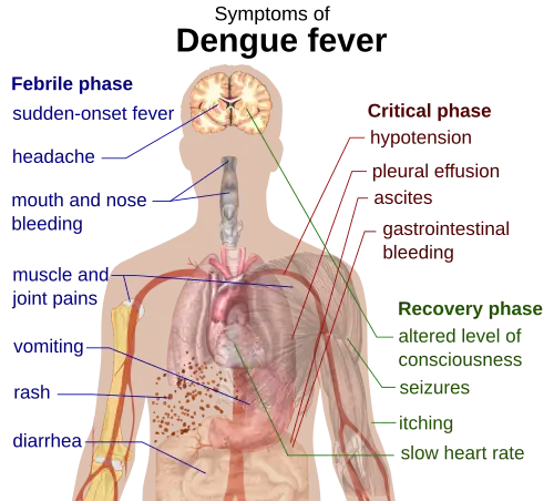 Outline of a human torso with arrows indicating the organs affected in the various stages of dengue fever