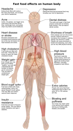 An diagram showing how fast food can affect the human body, including headaches, depression, acne, dental distress, heart disease or stroke, shortness of breath, high cholesterol, high blood pressure, weight gain, blood sugar spike, extra calories, insulin resistance, and bloating and puffiness.
