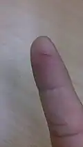 An incision: a small cut in a finger