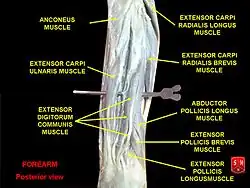 Extensor digitorum communis muscle