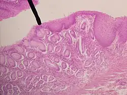 Histological section showing the gastroesophageal junction, with a black arrow pointing to the junction.