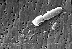 Electromicrograph of "Klebsiella pneumoniae"