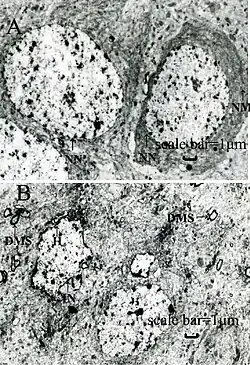 Two black-and-white photos; one shows dark, fairly regular rings on a lighter background, and the other shows irregular, smaller, and not as dark clusters.