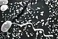 Microsporidian spore (Microsporidia)