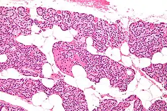 Intermediate magnification micrograph. H&E stain. The white round structures are fat cells. Adipose tissue comprises 25–40% of normal parathyroid gland tissue.[7]