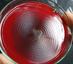 Proteus sp.: swarming behaviour on blood agar: 167