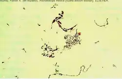 Photomicrograph of bacteria in intermediate-length chains