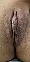 Darker toned labia minora demonstrating normal variation