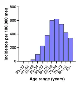 Graph showing that prostate cancer incidence is very low in men under 50, and peaks in men over 65