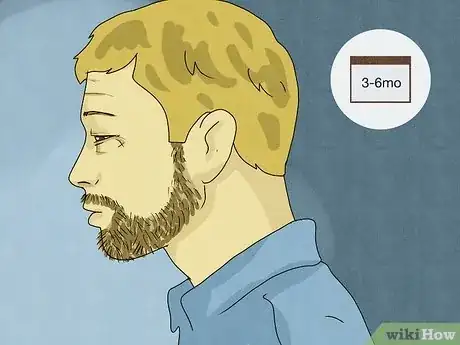 Image titled Date After the Death of a Spouse Step 1