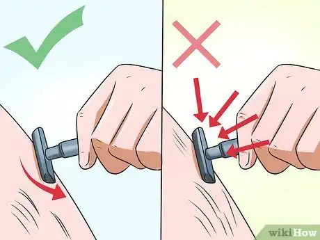 Image titled Get Rid of Ingrown Pimples Step 12