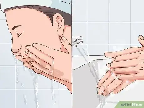 Image titled Treat Nodular Acne Step 7