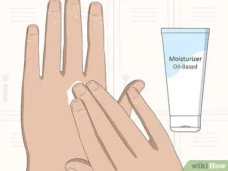 Image titled Heal Cracked Skin on Fingers Step 6