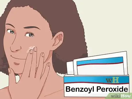 Image titled Treat Nodular Acne Step 8
