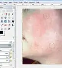 Remove Facial Blemishes on GIMP