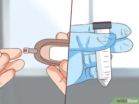 Image titled Treat a Human Bite Step 13