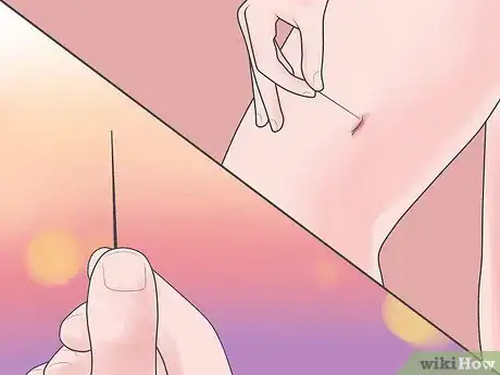 Image titled Remove Glass from a Wound Step 2