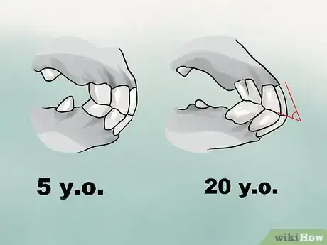 Image titled Tell a Horse's Age by Its Teeth Step 18