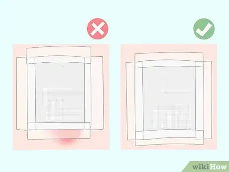 Image titled Cover a Burn Step 9