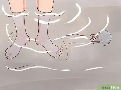 Image titled Avoid Getting Stung by Jellyfish Step 10