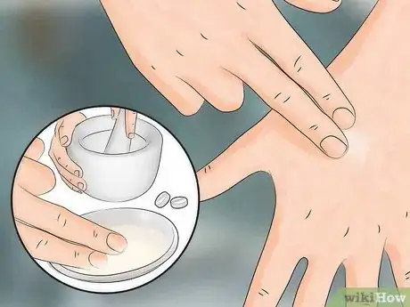 Image titled Reduce the Pain of Gnat Bites Step 4