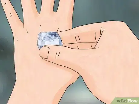 Image titled Reduce the Pain of Gnat Bites Step 7