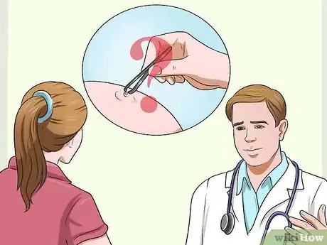 Image titled Get Rid of Ingrown Pimples Step 5