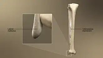 Image showing the lateral malleolus as part of the fibula.