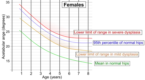 Acetabular index by age in females.[8]