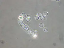 The heterolobosean protozoa species "Acrasis rosea" Olive & Stoian