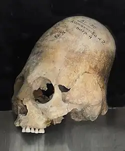 Photograph of an elongated human skull displayed at the Afrasiab Museum, Samarkand