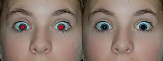 A photograph of a human with the red-eye effect and its correction right next to it