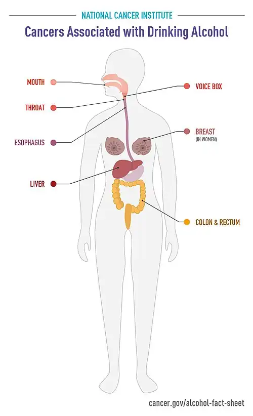 Cancers-associated-with-drinking-alcohol-infographic. It shows breast cancer, colorectal cancer, esophageal cancer, liver cancer, and head-and-neck cancers