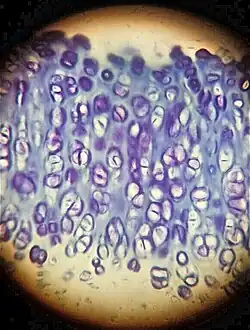 Hyaline cartilage coloured with the toluidine blue, in which you can observe a strong metachromasia of the ground substance. View through optical microscope, 40x magnification.