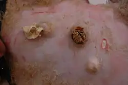 Caseous lymphadenitis