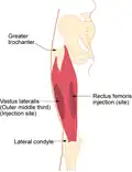Site for intramuscular injection into the vastus lateralis
