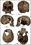 Burial 01 - Cranium