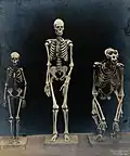 Skeleton of a man, a woman (pygmy) and a gorilla